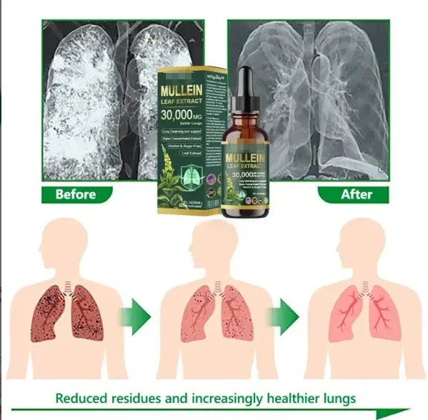 Mullein Drops for Lungs - Natural Respiratory Support & Lung Cleanse Supplement - 30,000mg High Potency Extract (Alcohol-Free) 9 mullein drops lung cleanse respiratory support goo bmhtbjgj desc 4