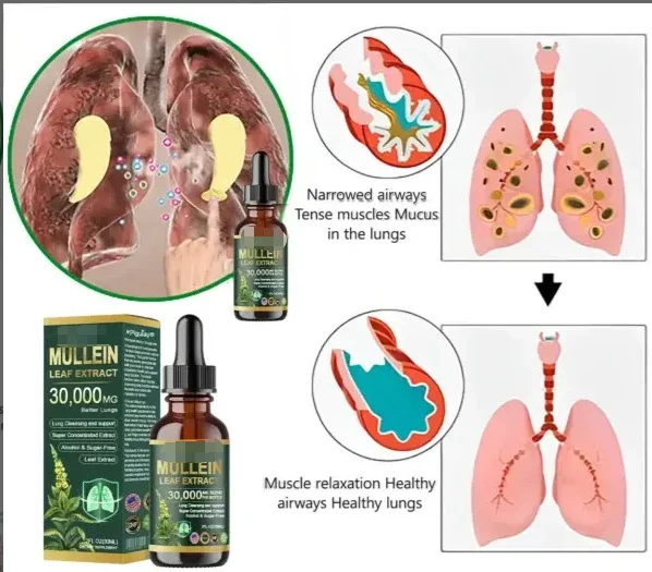 Mullein Drops for Lungs - Natural Respiratory Support & Lung Cleanse Supplement - 30,000mg High Potency Extract (Alcohol-Free) 11 mullein drops lung cleanse respiratory support goo bmhtbjgj desc 6